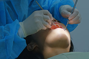 tratamiento odontologia churriana