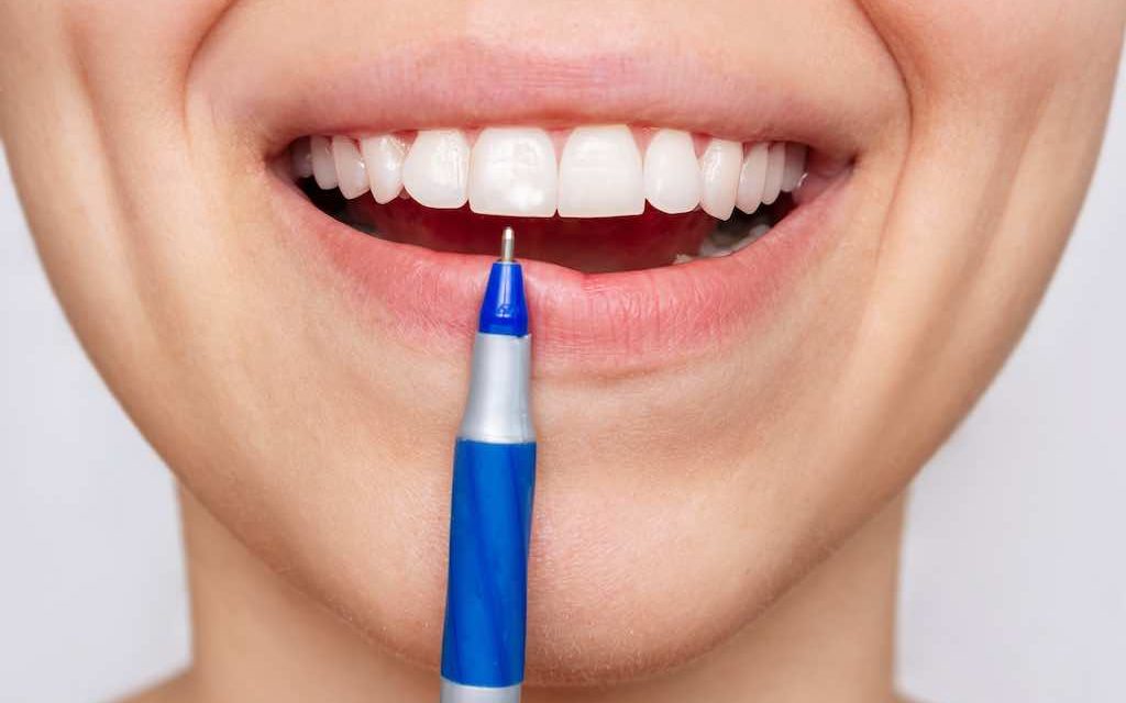 Manchas blancas en los dientes: causas y tratamientos
